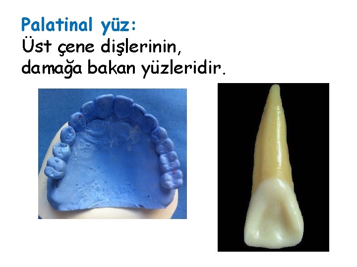 Palatinal yüz: Üst çene dişlerinin, damağa bakan yüzleridir. Palatinal yüz: Üst çene dişlerinin, damağa bakan yüzleridir.