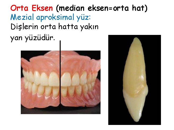 Orta Eksen (median eksen=orta hat) Mezial aproksimal yüz: Dişlerin orta hatta yakın yan yüzüdür. Orta Eksen (median eksen=orta hat) Mezial aproksimal yüz: Dişlerin orta hatta yakın yan yüzüdür.