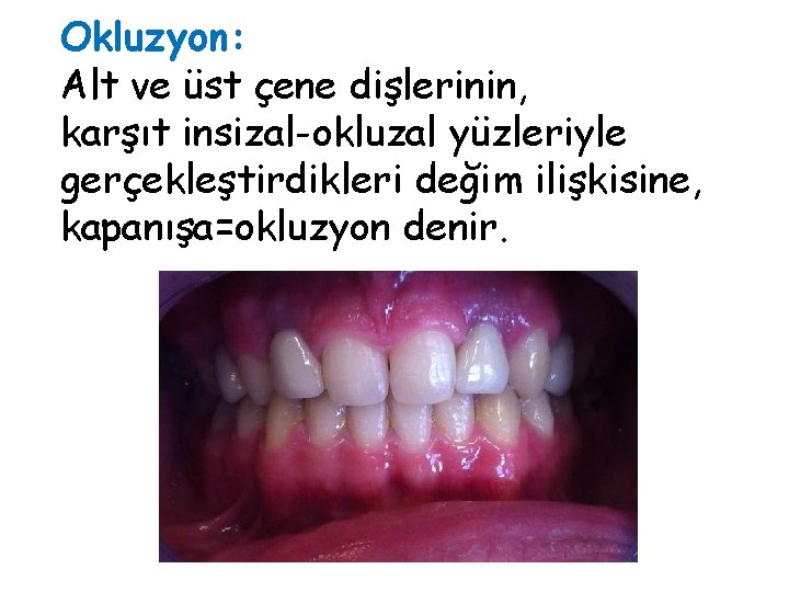 Okluzyon: Alt ve üst çene dişlerinin, karşıt insizal-okluzal yüzleriyle gerçekleştirdikleri değim ilişkisine, kapanışa=okluzyon denir. Okluzyon: Alt ve üst çene dişlerinin, karşıt insizal-okluzal yüzleriyle gerçekleştirdikleri değim ilişkisine, kapanışa=okluzyon denir.