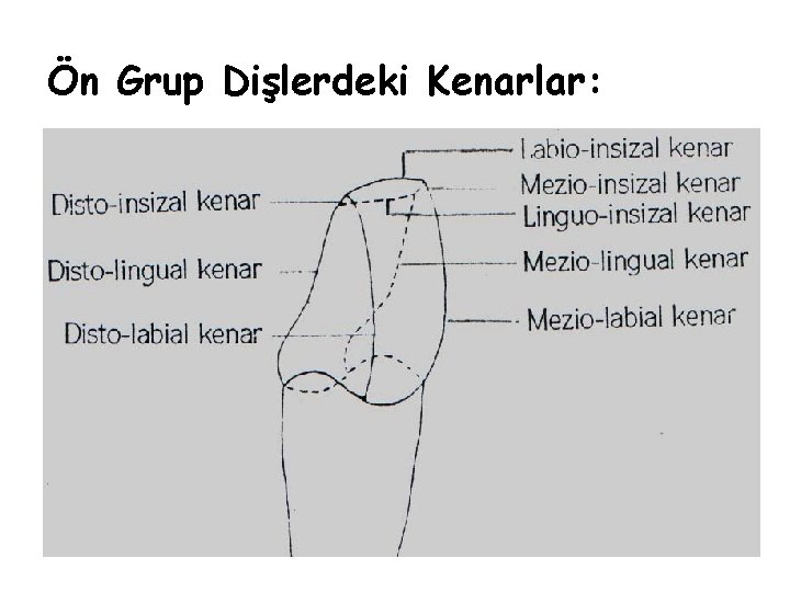 Ön Grup Dişlerdeki Kenarlar: Ön Grup Dişlerdeki Kenarlar: