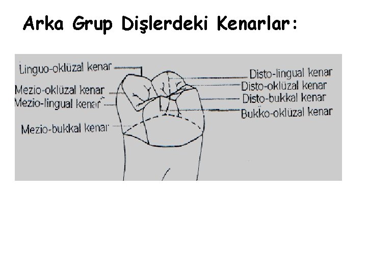 Arka Grup Dişlerdeki Kenarlar: Arka Grup Dişlerdeki Kenarlar: