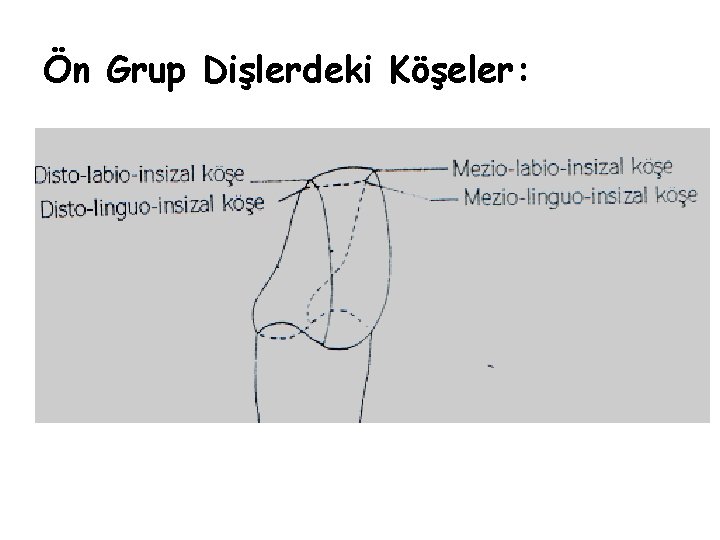 Ön Grup Dişlerdeki Köşeler: Ön Grup Dişlerdeki Köşeler: