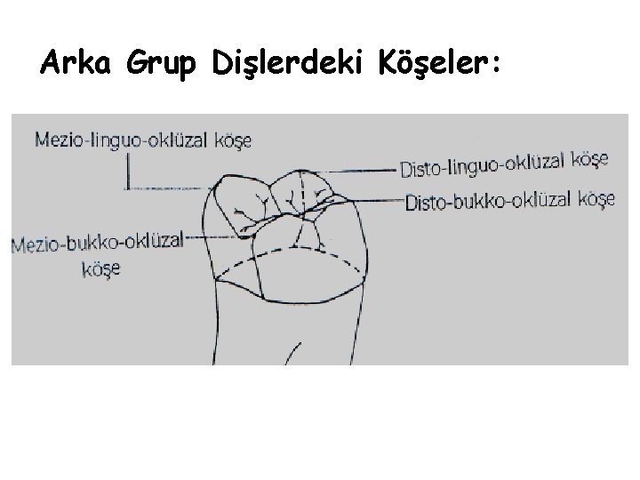 Arka Grup Dişlerdeki Köşeler: Arka Grup Dişlerdeki Köşeler: