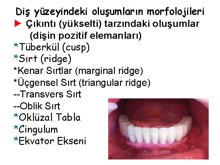 Diş yüzeyindeki oluşumların morfolojileri ► Çıkıntı (yükselti) tarzındaki oluşumlar (dişin pozitif elemanları) *Tüberkül (cusp) Diş yüzeyindeki oluşumların morfolojileri ► Çıkıntı (yükselti) tarzındaki oluşumlar (dişin pozitif elemanları) *Tüberkül (cusp)