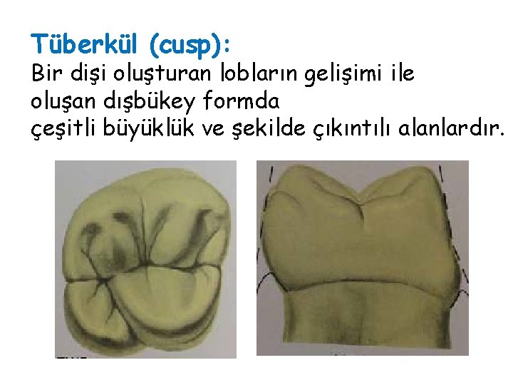 Tüberkül (cusp): Bir dişi oluşturan lobların gelişimi ile oluşan dışbükey formda çeşitli büyüklük ve Tüberkül (cusp): Bir dişi oluşturan lobların gelişimi ile oluşan dışbükey formda çeşitli büyüklük ve