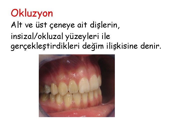 Okluzyon Alt ve üst çeneye ait dişlerin, insizal/okluzal yüzeyleri ile gerçekleştirdikleri değim ilişkisine denir. Okluzyon Alt ve üst çeneye ait dişlerin, insizal/okluzal yüzeyleri ile gerçekleştirdikleri değim ilişkisine denir.