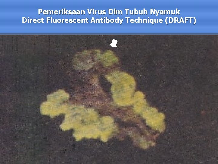 Pemeriksaan Virus Dlm Tubuh Nyamuk Direct Fluorescent Antibody Technique (DRAFT) 
