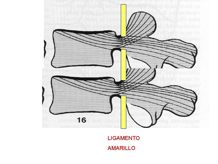 LIGAMENTO AMARILLO 