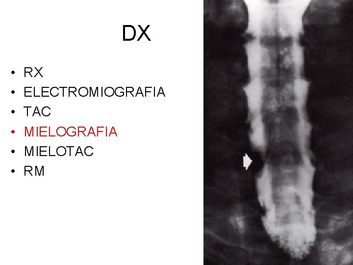 DX • • • RX ELECTROMIOGRAFIA TAC MIELOGRAFIA MIELOTAC RM 