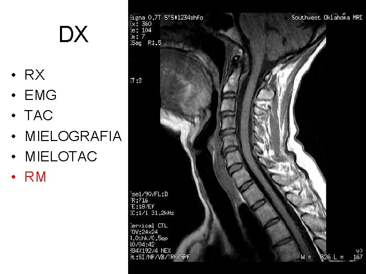DX • • • RX EMG TAC MIELOGRAFIA MIELOTAC RM 