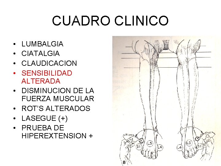 CUADRO CLINICO • • LUMBALGIA CIATALGIA CLAUDICACION SENSIBILIDAD ALTERADA DISMINUCION DE LA FUERZA MUSCULAR