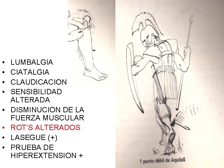  • • LUMBALGIA CIATALGIA CLAUDICACION SENSIBILIDAD ALTERADA DISMINUCION DE LA FUERZA MUSCULAR ROT’S