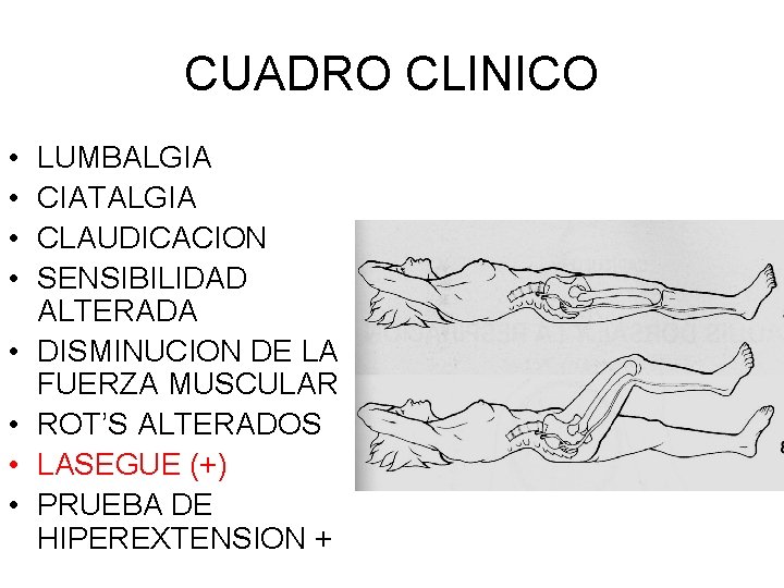 CUADRO CLINICO • • LUMBALGIA CIATALGIA CLAUDICACION SENSIBILIDAD ALTERADA DISMINUCION DE LA FUERZA MUSCULAR