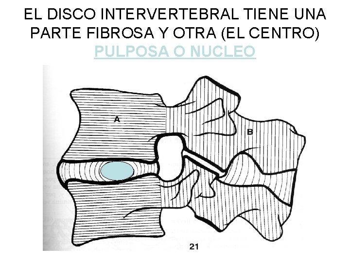 EL DISCO INTERVERTEBRAL TIENE UNA PARTE FIBROSA Y OTRA (EL CENTRO) PULPOSA O NUCLEO