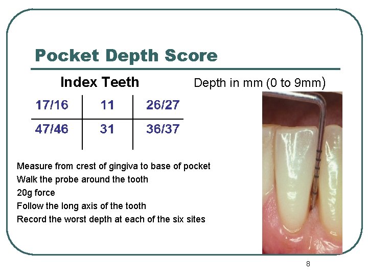 Pocket Depth Score Index Teeth Depth in mm (0 to 9 mm) Measure from