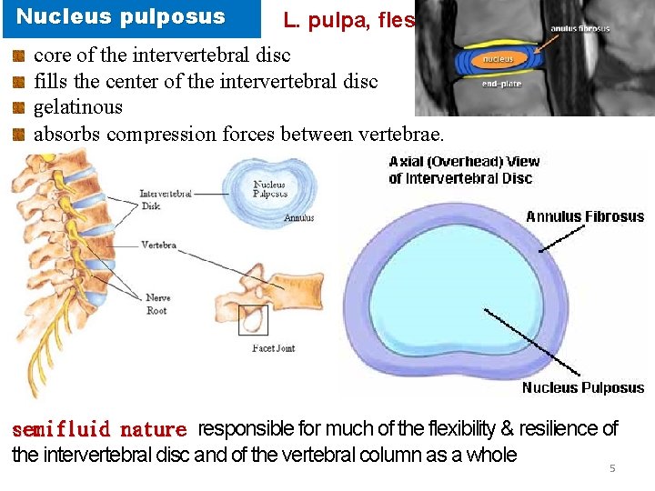 Nucleus pulposus L. pulpa, fleshy core of the intervertebral disc fills the center of