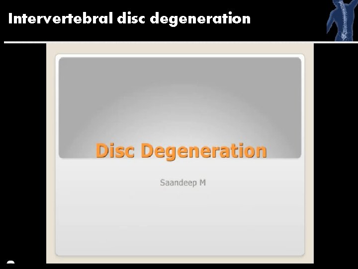 Intervertebral disc degeneration 54 