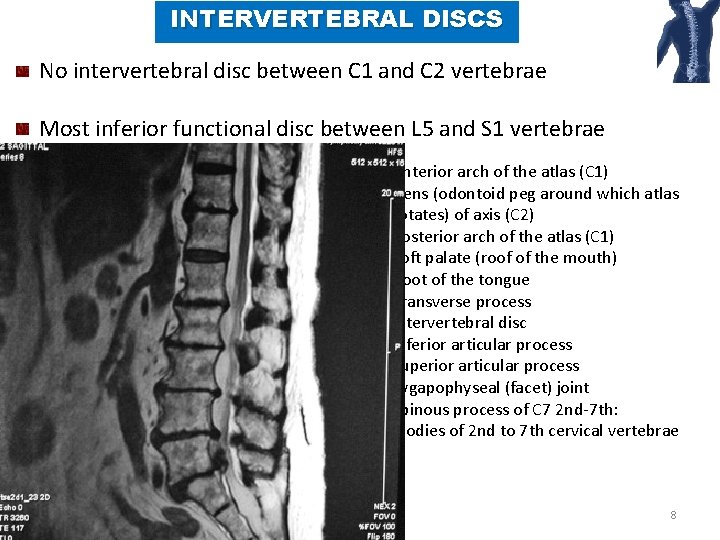 INTERVERTEBRAL DISCS No intervertebral disc between C 1 and C 2 vertebrae Most inferior