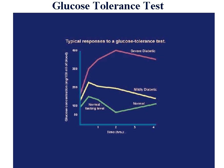 Glucose Tolerance Test 