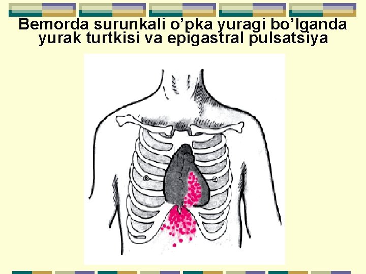 Bemorda surunkali o’pka yuragi bo’lganda yurak turtkisi va epigastral pulsatsiya 