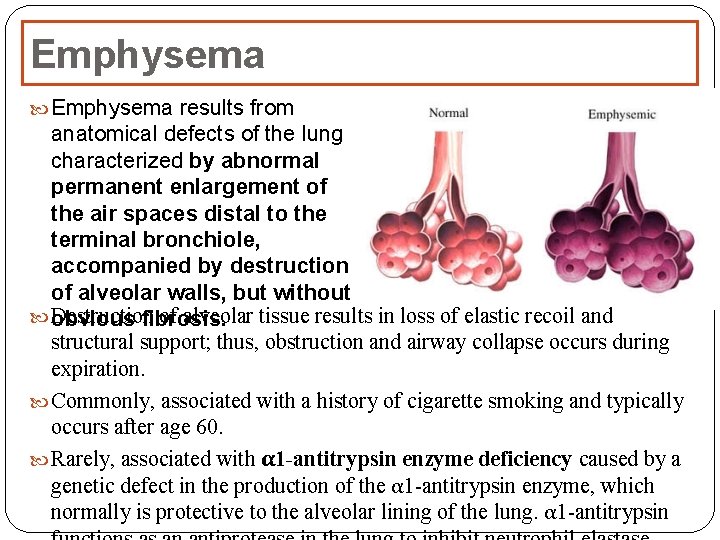 Emphysema results from anatomical defects of the lung characterized by abnormal permanent enlargement of Emphysema results from anatomical defects of the lung characterized by abnormal permanent enlargement of