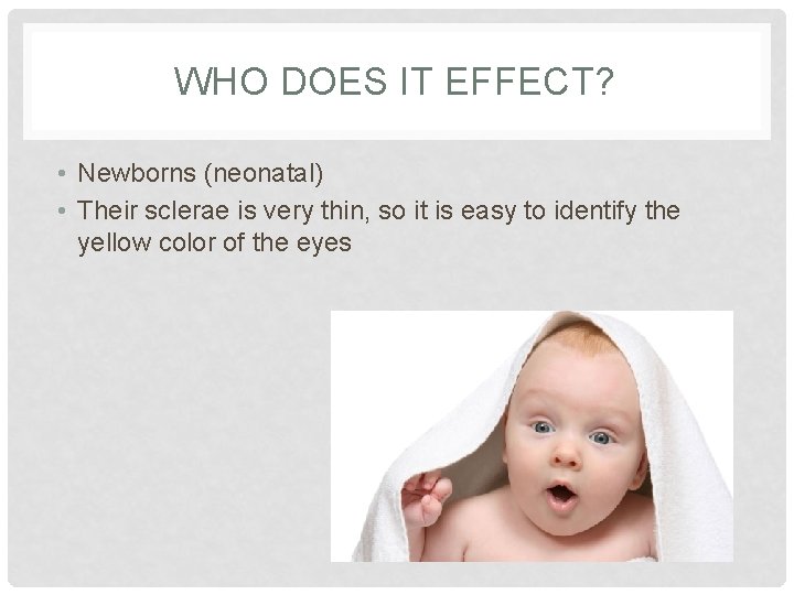WHO DOES IT EFFECT? • Newborns (neonatal) • Their sclerae is very thin, so