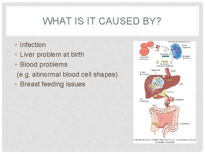 WHAT IS IT CAUSED BY? • Infection • Liver problem at birth • Blood