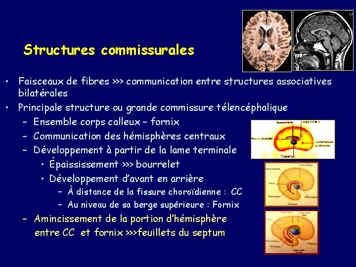 Structures commissurales • Faisceaux de fibres >>> communication entre structures associatives bilatérales • Principale