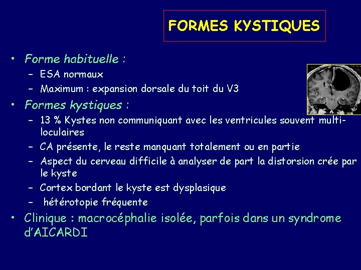 FORMES KYSTIQUES • Forme habituelle : – ESA normaux – Maximum : expansion dorsale