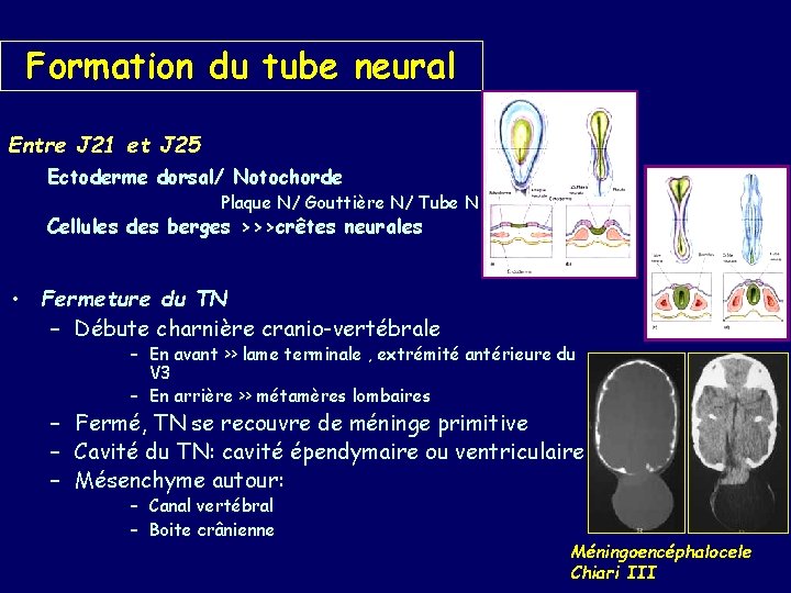 Formation du tube neural Entre J 21 et J 25 Ectoderme dorsal/ Notochorde Plaque