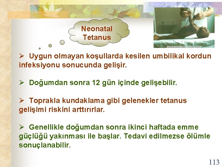 Neonatal Tetanus Ø Uygun olmayan koşullarda kesilen umbilikal kordun infeksiyonu sonucunda gelişir. Ø Doğumdan