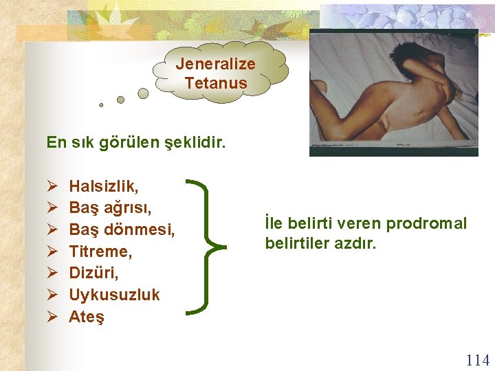 Jeneralize Tetanus En sık görülen şeklidir. Ø Halsizlik, Ø Baş ağrısı, Ø Baş dönmesi,