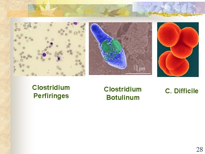 Clostridium Perfiringes Clostridium Botulinum C. Difficile 28 