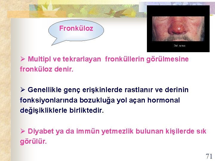 Fronküloz Ø Multipl ve tekrarlayan fronküllerin görülmesine fronküloz denir. Ø Genellikle genç erişkinlerde rastlanır