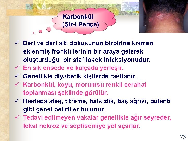 Karbonkül (Şir-i Pençe) ü Deri ve deri altı dokusunun birbirine kısmen eklenmiş fronküllerinin bir