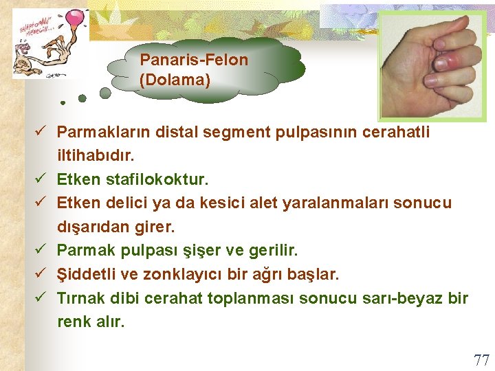 Panaris-Felon (Dolama) ü Parmakların distal segment pulpasının cerahatli iltihabıdır. ü Etken stafilokoktur. ü Etken