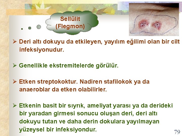 Sellülit (Flegmon) Ø Deri altı dokuyu da etkileyen, yayılım eğilimi olan bir cilt infeksiyonudur.