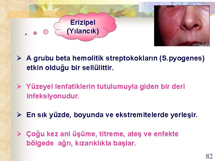 Erizipel (Yılancık) Ø A grubu beta hemolitik streptokokların (S. pyogenes) etkin olduğu bir sellülittir.