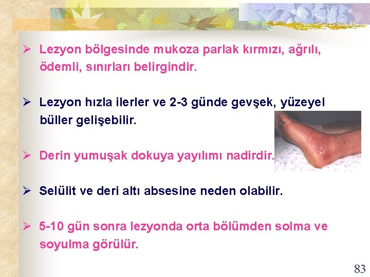 Ø Lezyon bölgesinde mukoza parlak kırmızı, ağrılı, ödemli, sınırları belirgindir. Ø Lezyon hızla ilerler