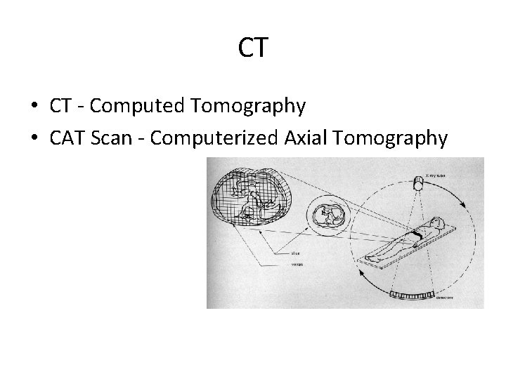 CT • CT - Computed Tomography • CAT Scan - Computerized Axial Tomography 