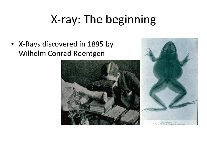 X-ray: The beginning • X-Rays discovered in 1895 by Wilhelm Conrad Roentgen 