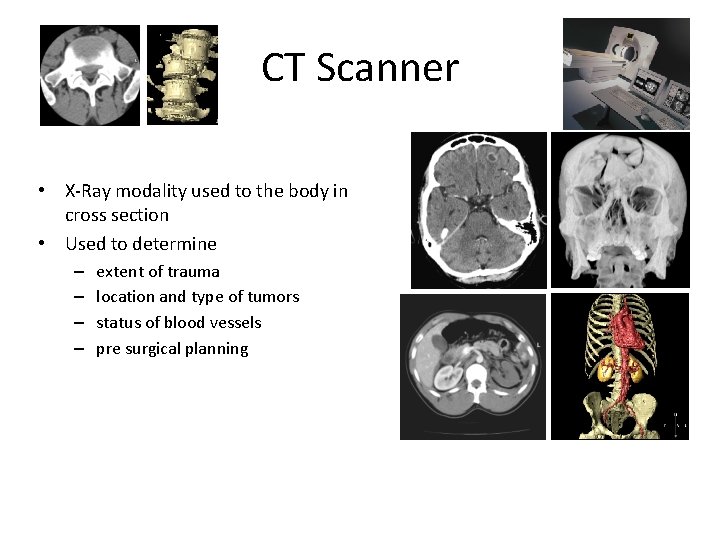 CT Scanner • X-Ray modality used to the body in cross section • Used