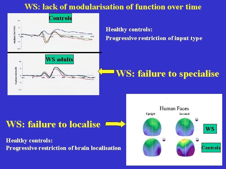 WS: lack of modularisation of function over time Controls Healthy controls: Progressive restriction of