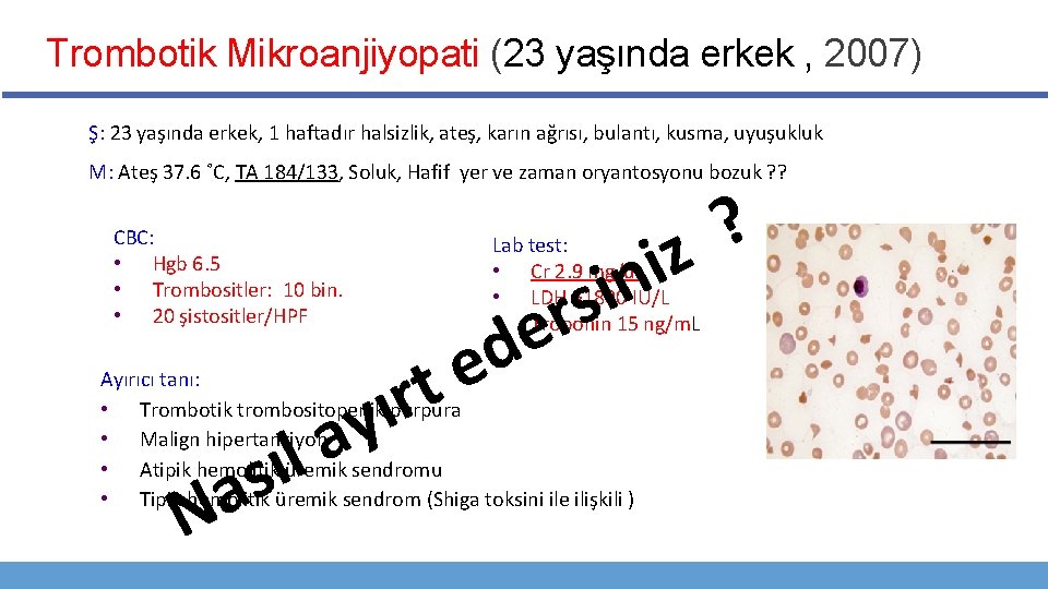 Trombotik Mikroanjiyopati (23 yaşında erkek , 2007) Ş: 23 yaşında erkek, 1 haftadır halsizlik,