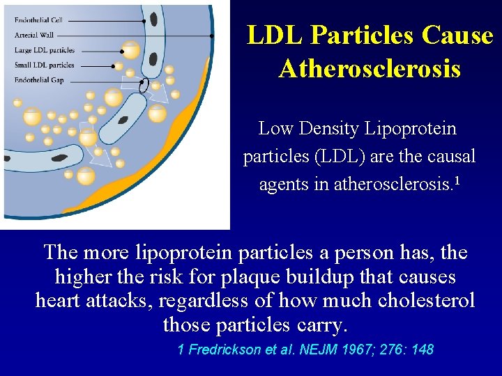 LDL Particles Cause Atherosclerosis Low Density Lipoprotein particles (LDL) are the causal agents in