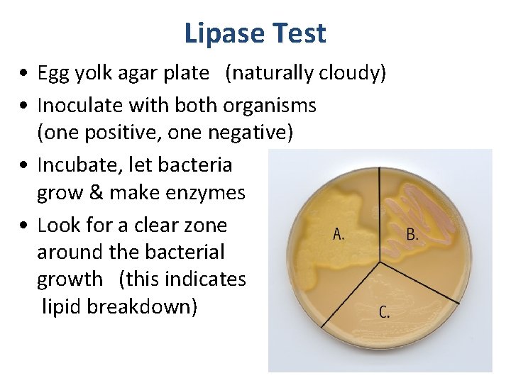 Lipase Test • Egg yolk agar plate (naturally cloudy) • Inoculate with both organisms