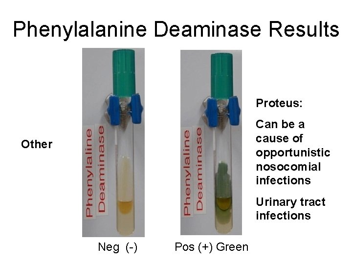 Phenylalanine Deaminase Results Proteus: Can be a cause of opportunistic nosocomial infections Other Urinary