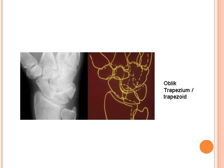 Oblik Trapezium / trapezoid 