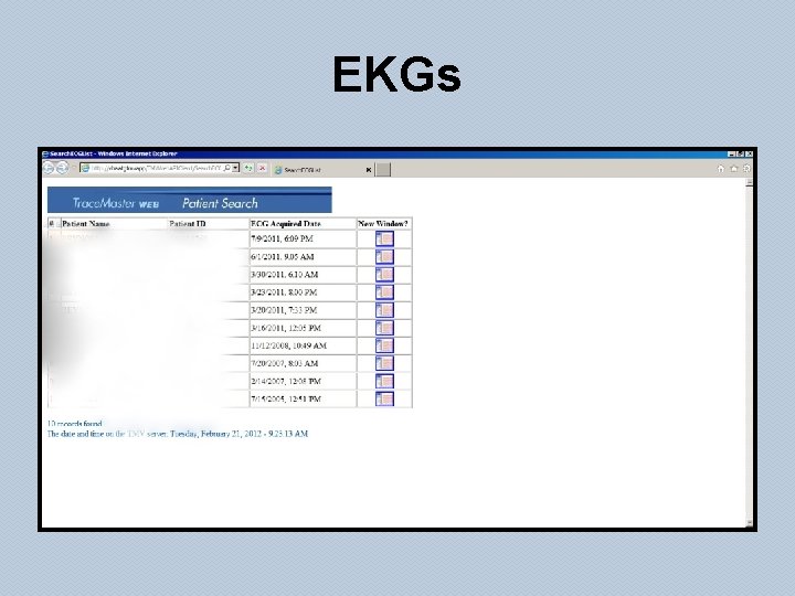 EKGs 