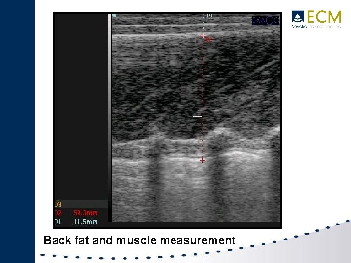 Back fat and muscle measurement 